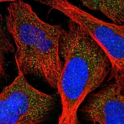 AGXT Antibody, Novus Biologicals:Antibodies:Primary Antibodies